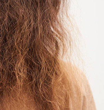 frizzy hair